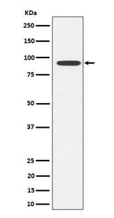Anti-Glyt2 Rabbit Monoclonal Antibody Boster Bio
