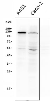 Anti-P-Cadherin-3 CDH3-Antibody Picoband® (monoclonal, 3C9 Boster Bio