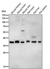 Anti-PAX9 Rabbit Monoclonal Antibody Boster Bio