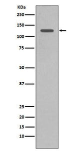 Anti-SHIP INPP5D Rabbit Monoclonal Antibody Boster Bio