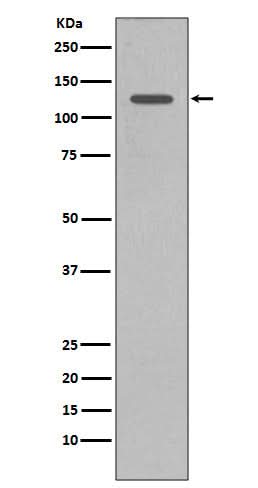 Anti-SHIP INPP5D Rabbit Monoclonal Antibody Boster Bio