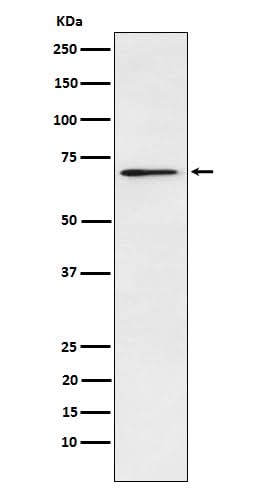 Anti-Plastin L Rabbit Monoclonal Antibody Boster Bio