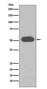 Anti-GC / VDBP Rabbit Monoclonal Antibody Boster Bio