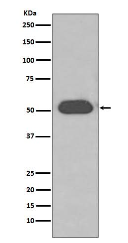 Anti-GC / VDBP Rabbit Monoclonal Antibody Boster Bio