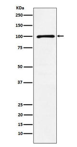 Anti-GRIK2 Rabbit Monoclonal Antibody Boster Bio