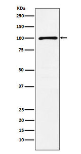 Anti-GRIK2 Rabbit Monoclonal Antibody Boster Bio