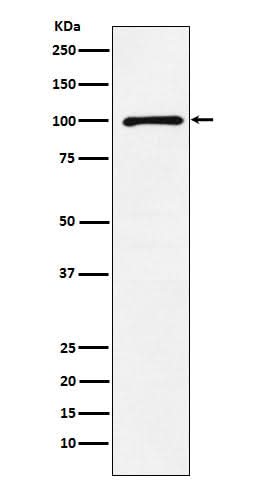 Anti-GRIK2 Rabbit Monoclonal Antibody Boster Bio