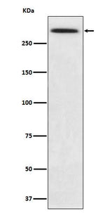 Anti-SPTA1 Rabbit Monoclonal Antibody Boster Bio