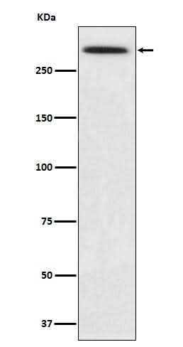 Anti-SPTA1 Rabbit Monoclonal Antibody Boster Bio
