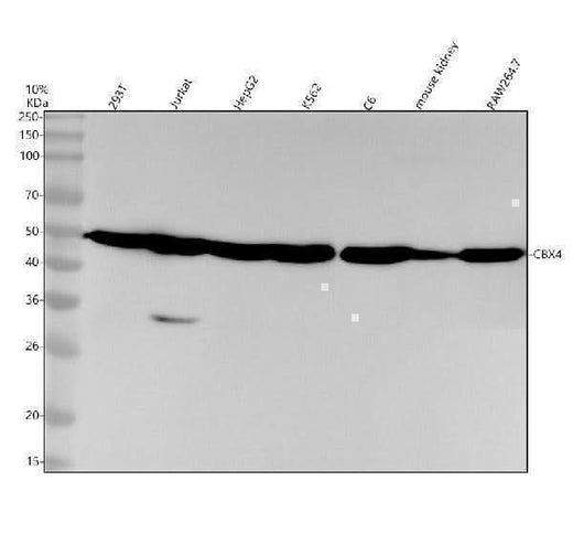 Anti-CBX4 Rabbit Monoclonal Antibody Boster Bio