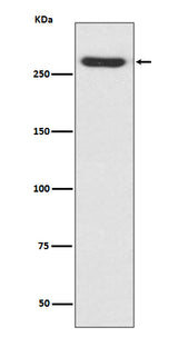 Anti-NG2 CSPG4 Rabbit Monoclonal Antibody Boster Bio