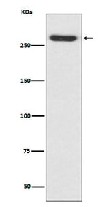Anti-NG2 CSPG4 Rabbit Monoclonal Antibody Boster Bio