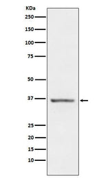 Anti-STC1 Rabbit Monoclonal Antibody Boster Bio