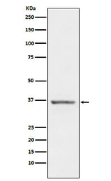 Anti-STC1 Rabbit Monoclonal Antibody Boster Bio