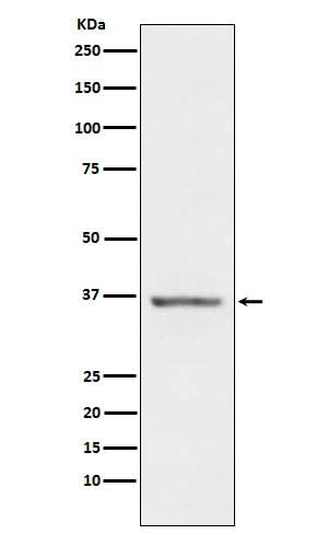Anti-STC1 Rabbit Monoclonal Antibody Boster Bio