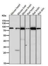 Anti-TNPO3 Rabbit Monoclonal Antibody Boster Bio
