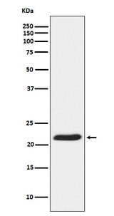 Anti-TCTP Rabbit Monoclonal Antibody Boster Bio