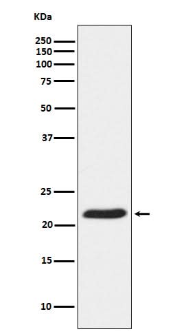 Anti-TCTP Rabbit Monoclonal Antibody Boster Bio