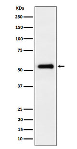 Anti-PRD Rabbit Monoclonal Antibody Boster Bio