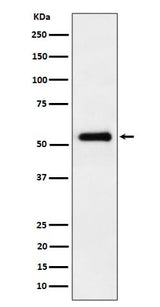 Anti-PRD Rabbit Monoclonal Antibody Boster Bio