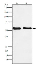 Anti-KLF10 Rabbit Monoclonal Antibody Boster Bio