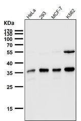 Anti-SMN1 Rabbit Monoclonal Antibody Boster Bio