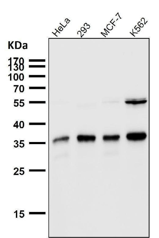 Anti-SMN1 Rabbit Monoclonal Antibody Boster Bio