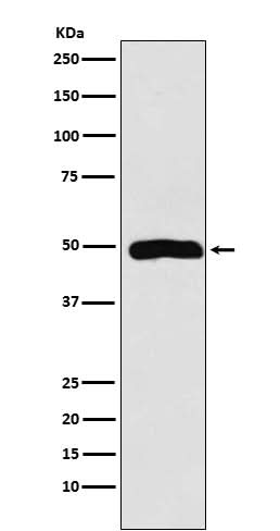 Anti-Arp3 Rabbit Monoclonal Antibody Boster Bio