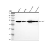 Anti-DARPP32 PPP1R1B Rabbit Monoclonal Antibody Boster Bio
