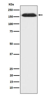 Anti-SUPT5H Rabbit Monoclonal Antibody Boster Bio