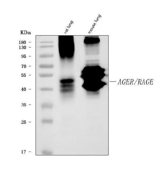 Anti-RAGE/AGER Antibody Picoband® (monoclonal, 5C6C1 Boster Bio