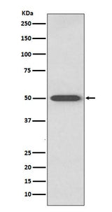 Anti-RAGE Rabbit Monoclonal Antibody Boster Bio
