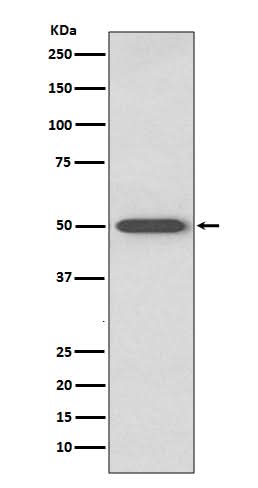 Anti-RAGE Rabbit Monoclonal Antibody Boster Bio