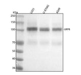 Anti-ApoER2 Monoclonal Antibody Boster Bio