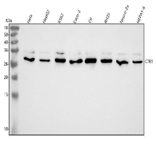 Anti-CTR1/SLC31A1 Rabbit Monoclonal Antibody Boster Bio