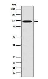 Anti-RanBP9 Rabbit Monoclonal Antibody Boster Bio