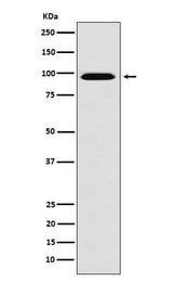 Anti-RanBP9 Rabbit Monoclonal Antibody Boster Bio