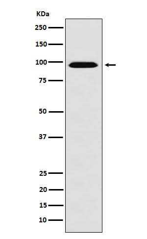 Anti-RanBP9 Rabbit Monoclonal Antibody Boster Bio