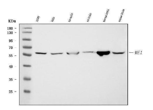 Anti-ME1 Antibody Picoband® (monoclonal, 5E5F7 Boster Bio