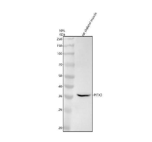 Anti-PITX3 Rabbit Monoclonal Antibody Boster Bio