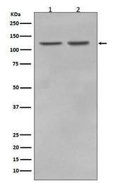 Anti-RNF20 Rabbit Monoclonal Antibody Boster Bio