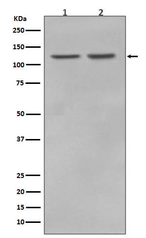 Anti-RNF20 Rabbit Monoclonal Antibody Boster Bio