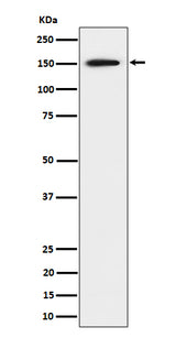 Anti-SAFB Rabbit Monoclonal Antibody Boster Bio