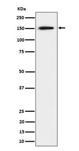 Anti-SAFB Rabbit Monoclonal Antibody Boster Bio
