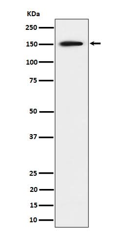 Anti-SAFB Rabbit Monoclonal Antibody Boster Bio