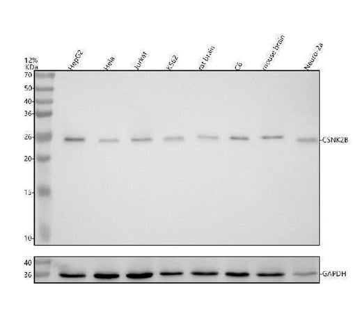 Anti-Casein Kinase 2 beta Monoclonal Antibody Boster Bio