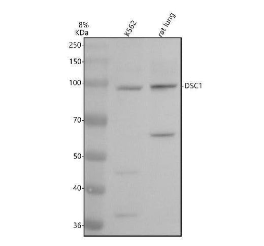 Anti-Desmocollin 1 Rabbit Monoclonal Antibody Boster Bio
