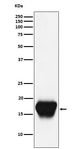 Anti-CD52 Monoclonal Antibody Boster Bio