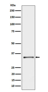 Anti-CYB5R3 Rabbit Monoclonal Antibody Boster Bio