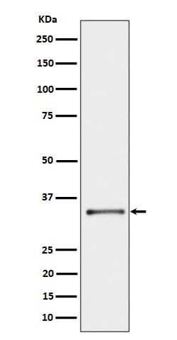 Anti-CYB5R3 Rabbit Monoclonal Antibody Boster Bio
